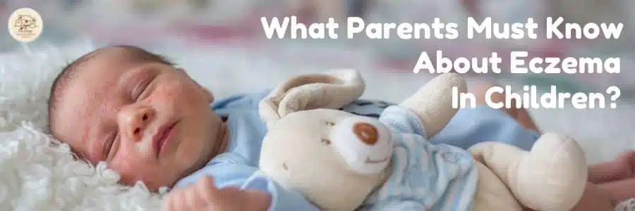 What Parents Must Know About Eczema In Children?