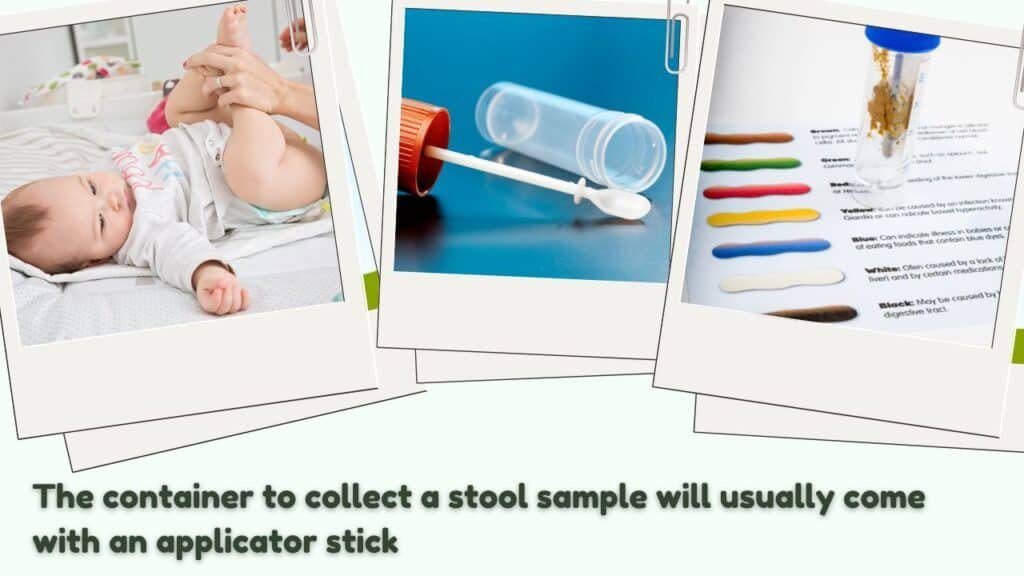 stool sample - diagnostic tests