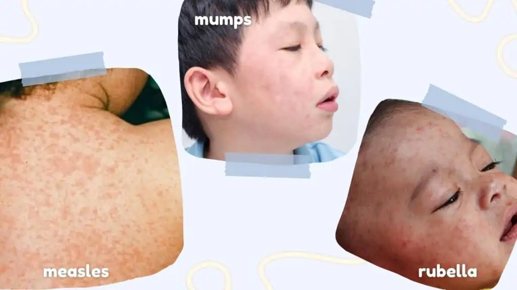 MMR - childhood vaccinations
