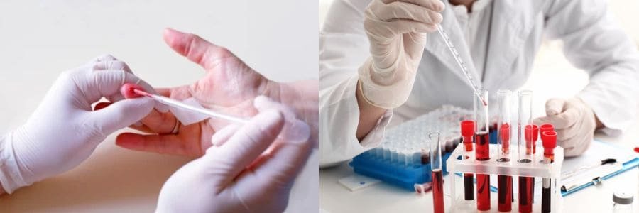 5 Jenis Ujian Diagnostik Disediakan di Klinik