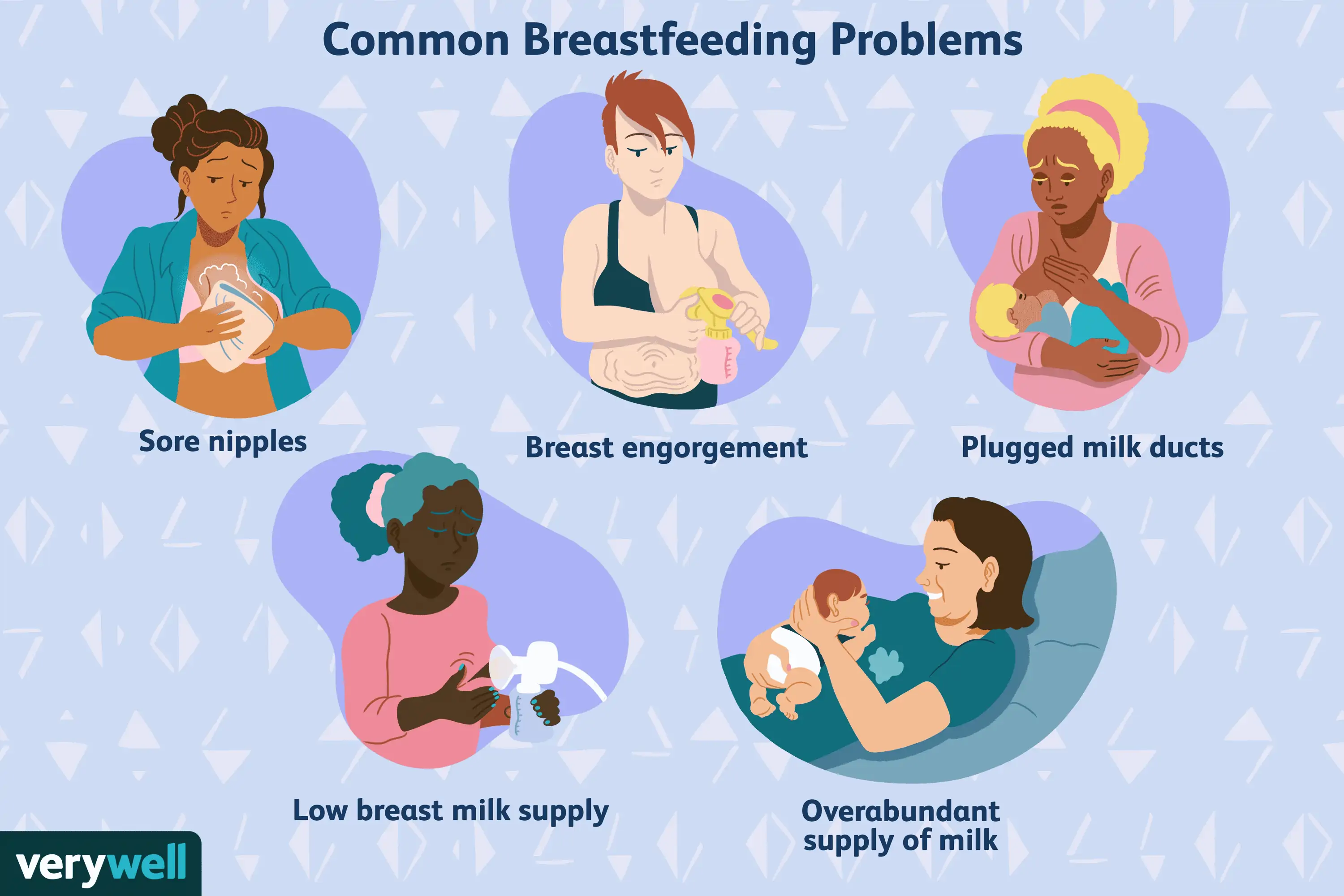 Your Pump Is Not Your Baby 2 Verywell - Common Breastfeeding Problems