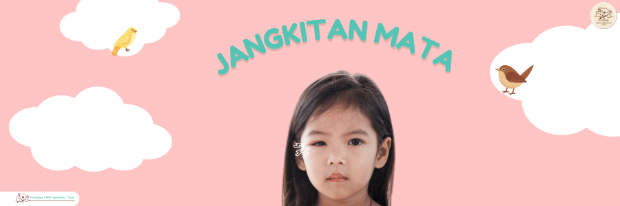 JANGKITAN MATA