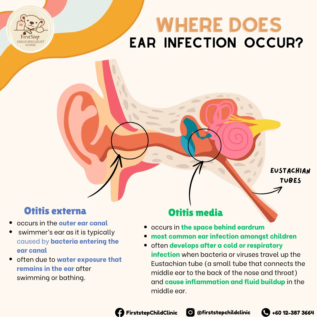 ear infection