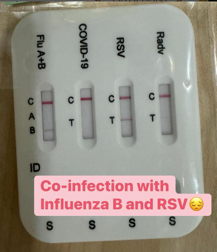 Jangkitan influenza