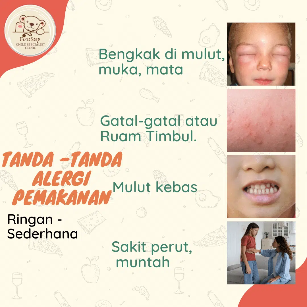 Steroid untuk Kanak-Kanak: Musuh atau Penyelamat? 1 tanda-tanda alergi