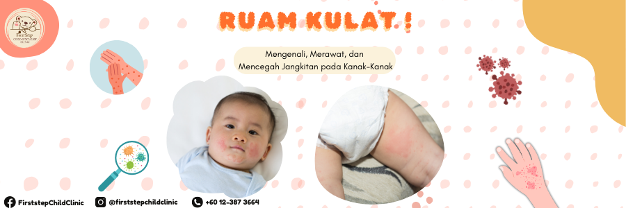 Ruam Kulat Pada Bayi