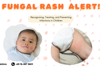 Fungal Rash In Baby