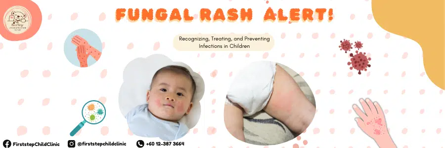Fungal Rash In Baby