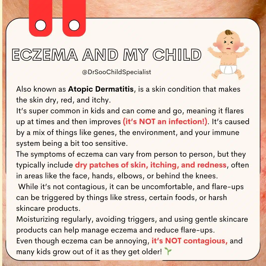 eczema