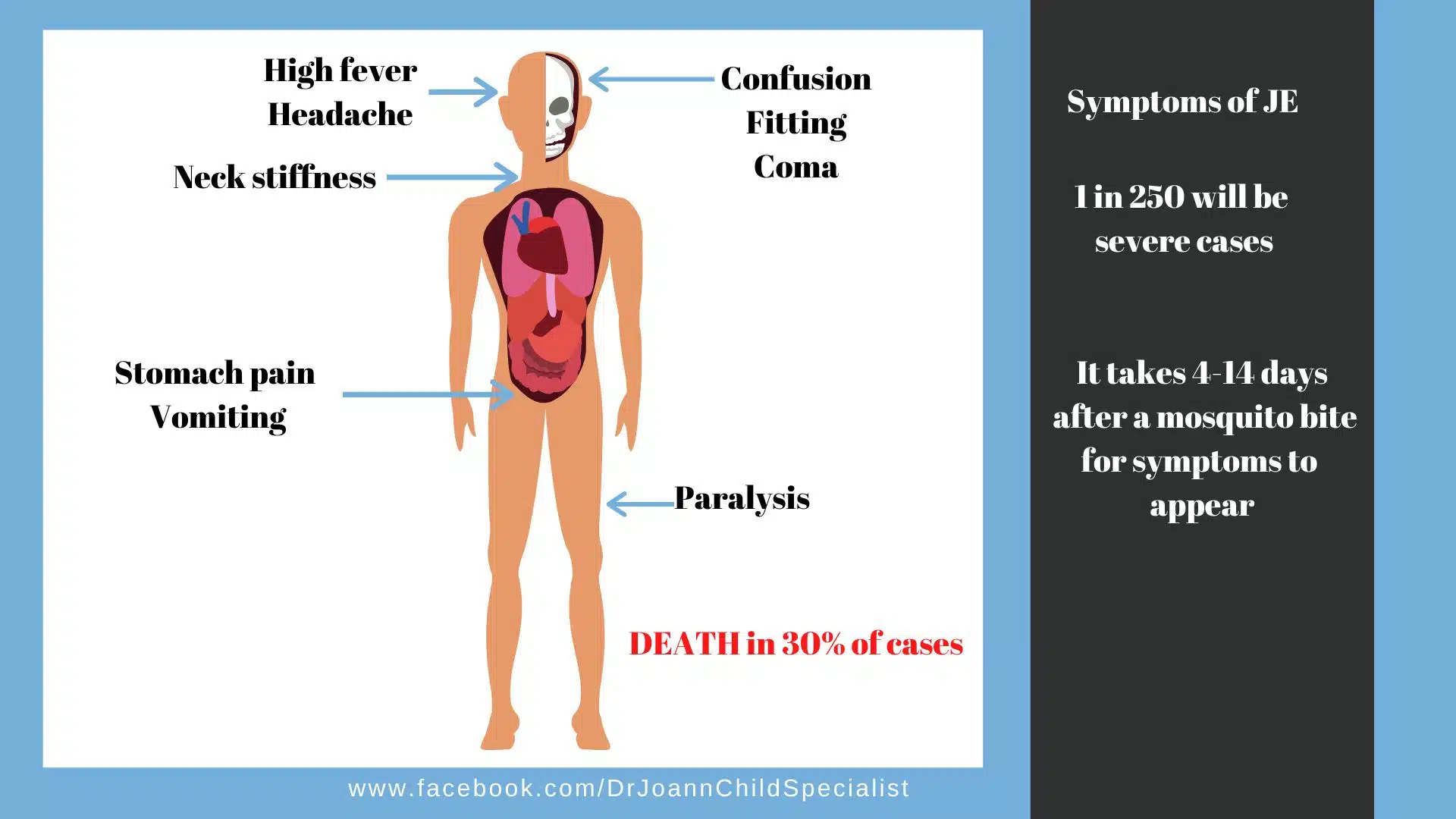Japanese Encephalitis (JE) 2 JE Dr JoAnn