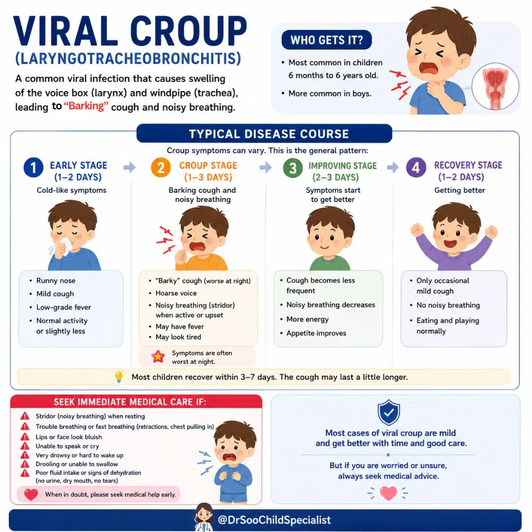 viral croup, child, specialist